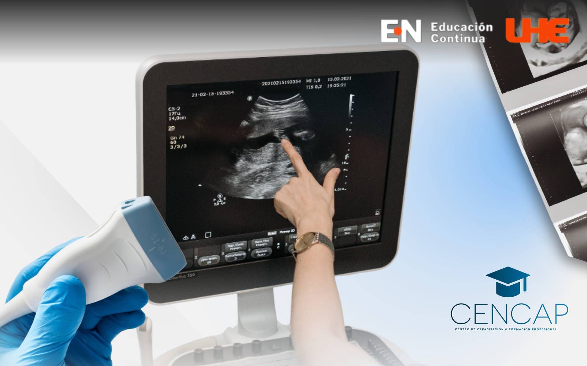 Diplomado En Ecografía General