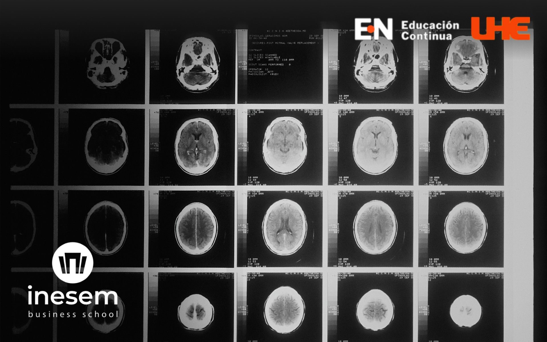 Diplomado en Neuroeducación